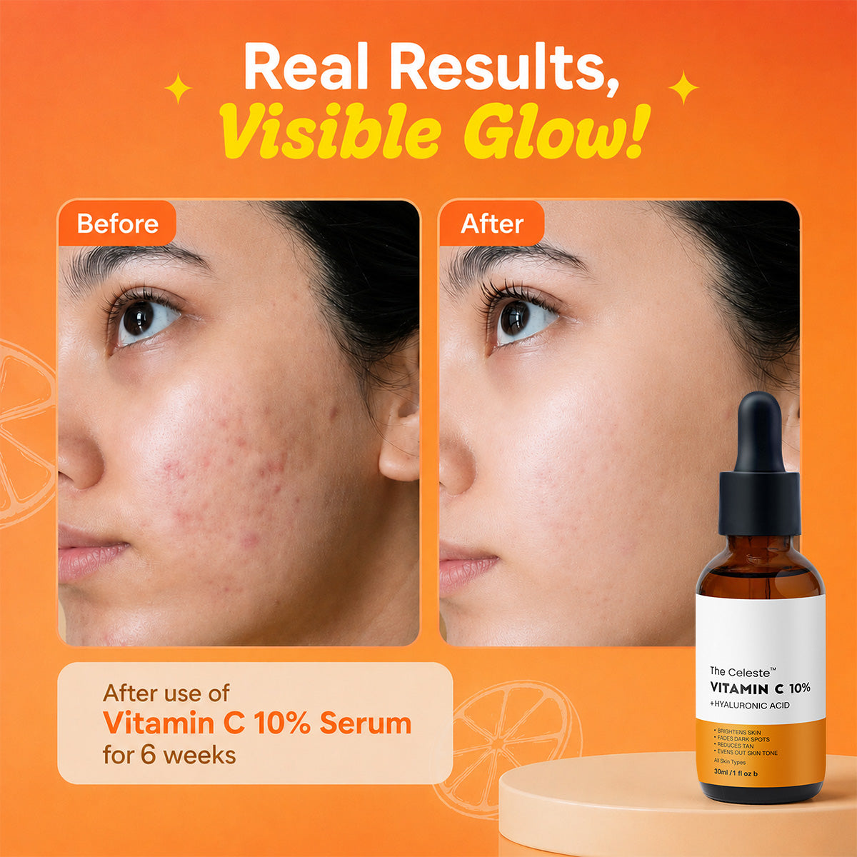 The Celeste Vitamin C 10%