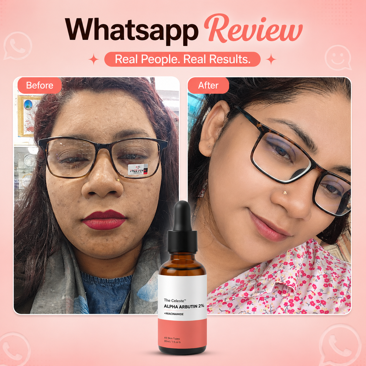 The Celeste Alpha Arbutin 2%