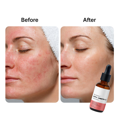 The-Celeste-Alpha-Arbutin-Serum-Before-after