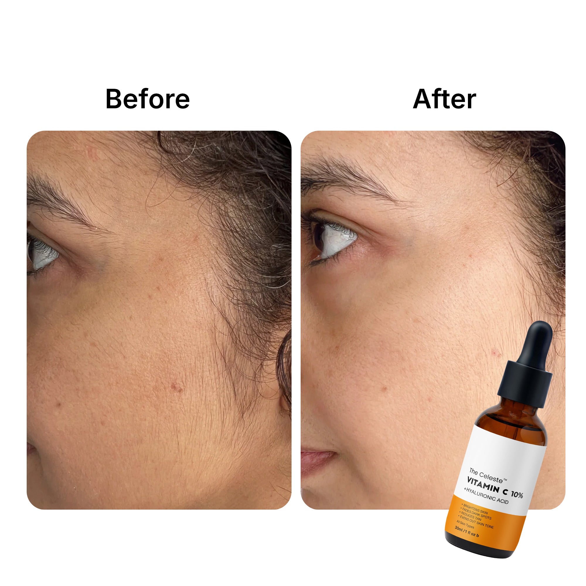The-Celeste-Vitamin-C-Serum-before-after