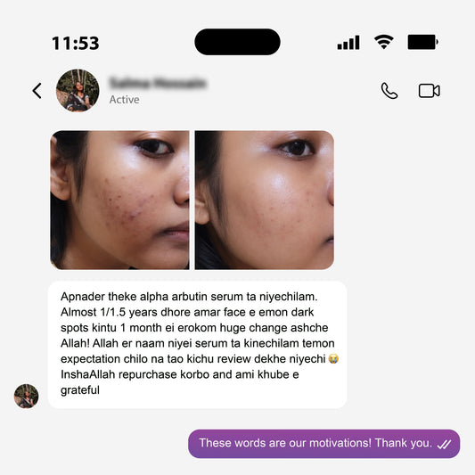 The Celeste Alpha Arbutin 2%